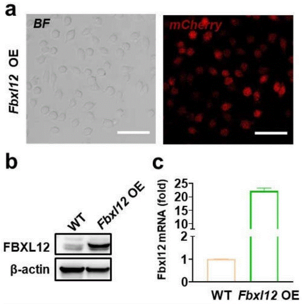FBXL12基因及其编码蛋白的用途