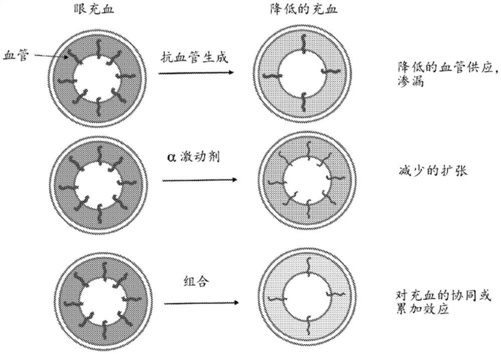 治疗眼充血的组合物及用其治疗眼充血的方法