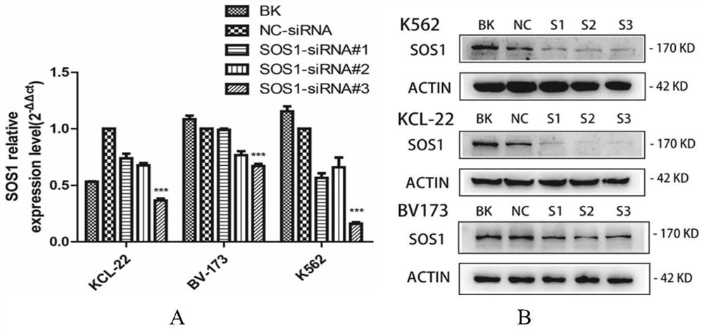 一种靶向抑制SOS1基因表达的siRNA及其应用