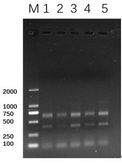 华支睾吸虫和东方次睾吸虫囊蚴感染双重PCR检测方法
