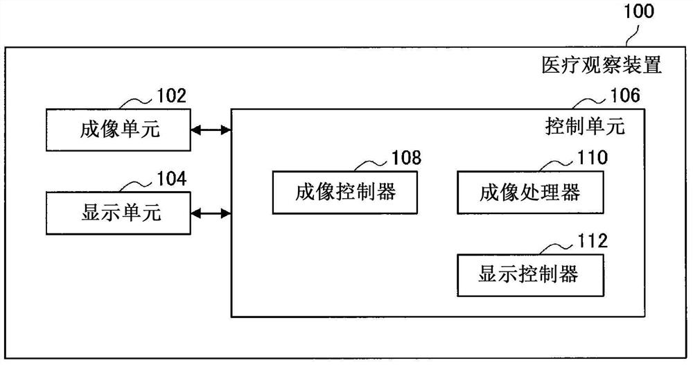 医疗图像处理装置