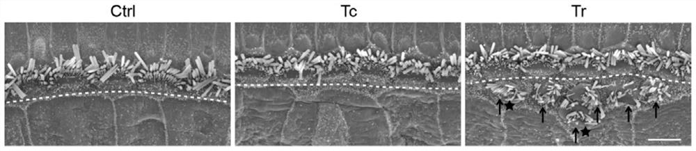 一种促进耳蜗毛细胞再生的肽段Tr及其应用