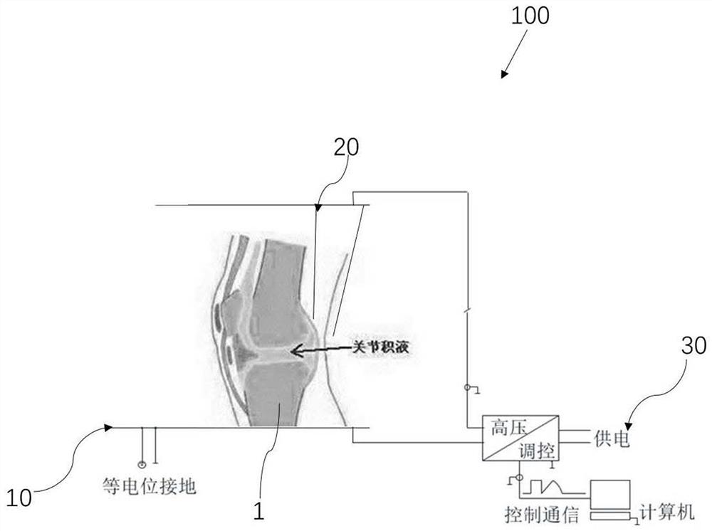 电场发生装置及其用途以及应用其排出疾患积液的方法