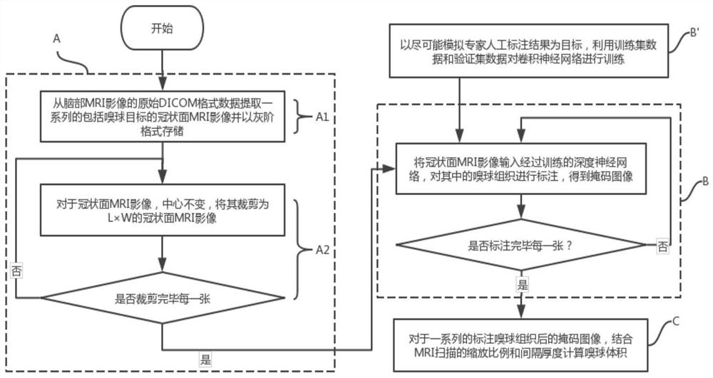 MRI嗅球体积检测方法、计算机装置、计算机可读存储介质