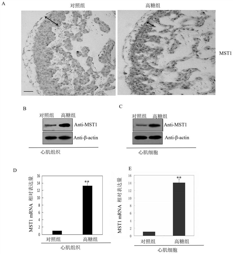 MST1基因在检测和/或调控心肌细胞过度凋亡中的应用