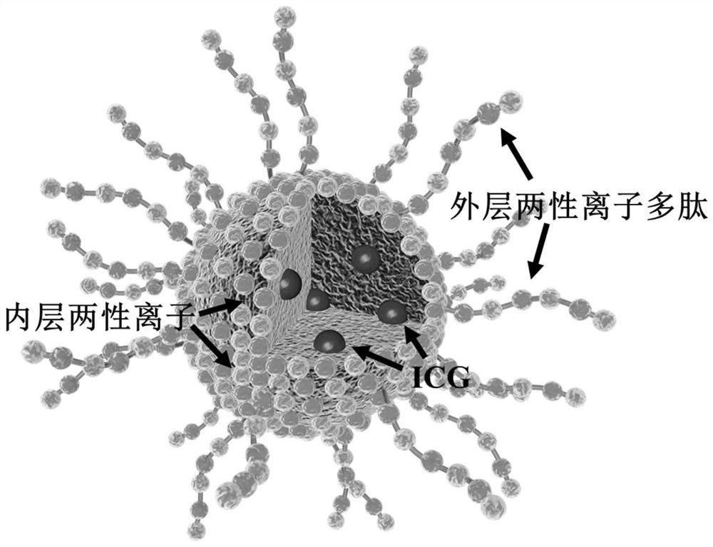 一种吲哚菁绿纳米药物及其制备方法