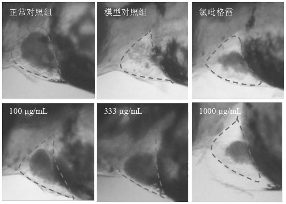 一种抗氧化和增强免疫力的中药组合物及其制备方法和应用