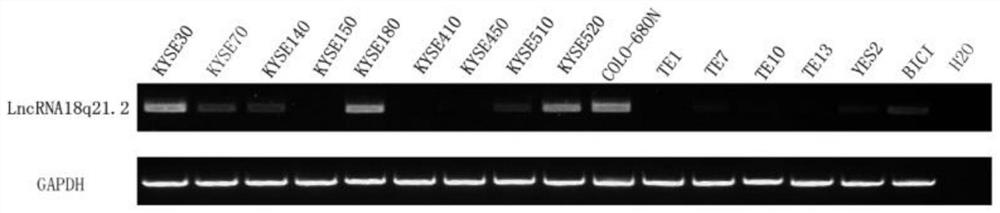 LncRNA18q21.2在作为诊断食管癌的标志物中的应用、引物对和试剂盒