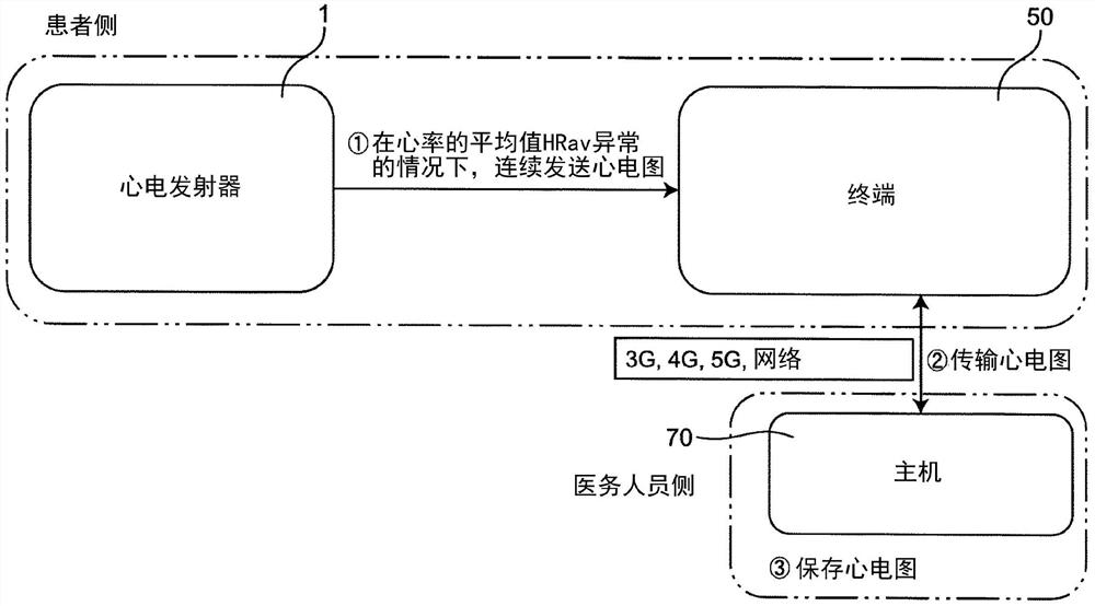 心电测量系统及心电发射器