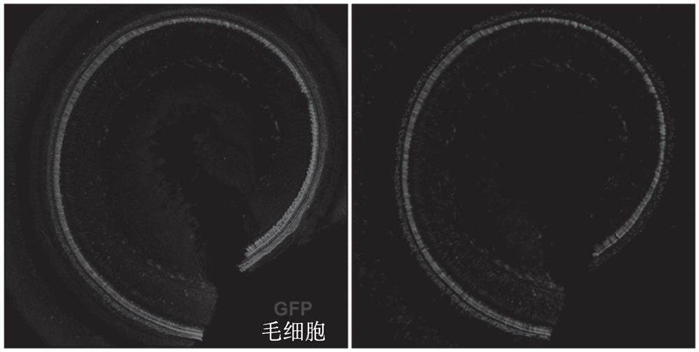 将核酸递送至耳蜗和前庭细胞的组合物和方法