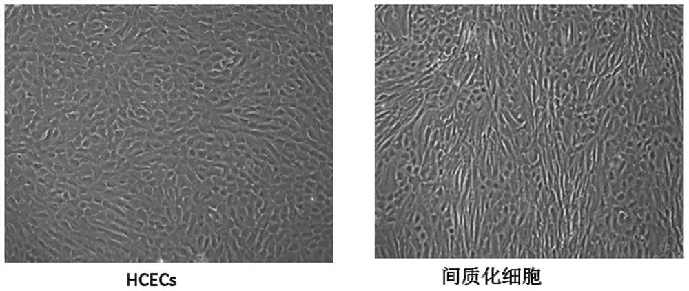 一种人类角膜内皮细胞的鉴定方法