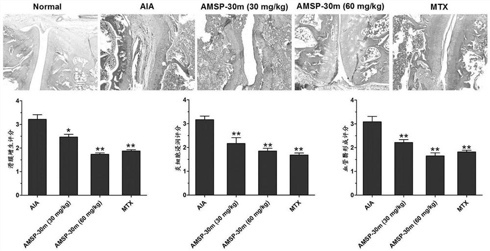 吡啶甲酰胺衍生物AMSP-30m在制备防治类风湿关节炎药物中的应用