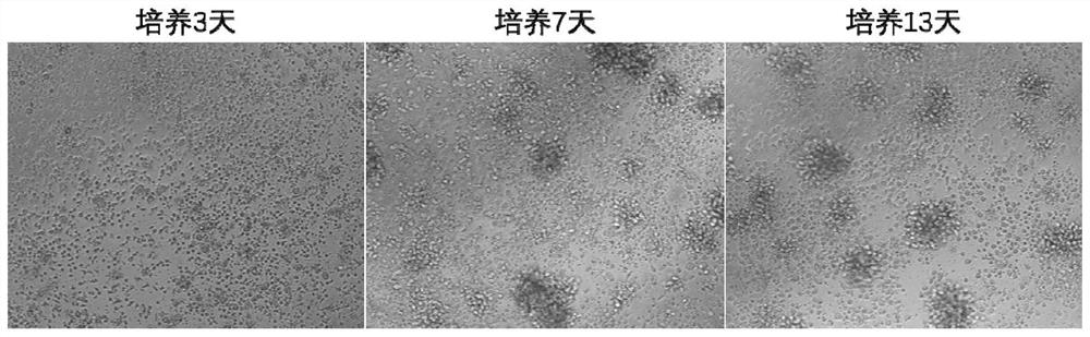 一种NKT细胞培养方法