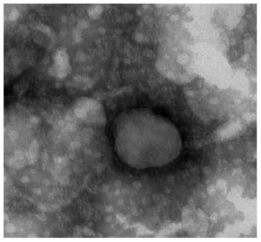 新流法腺四联病毒样颗粒及其制备方法和应用