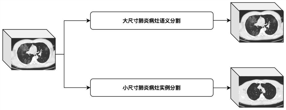 一种用于肺炎病灶分割的系统及方法