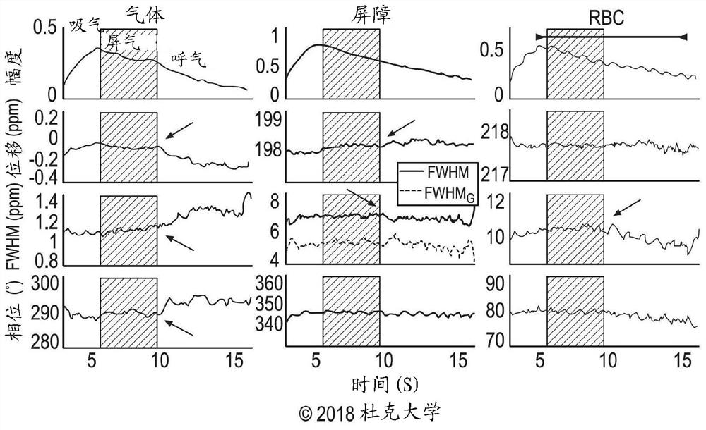 动态超极化129Xe气体交换光谱法