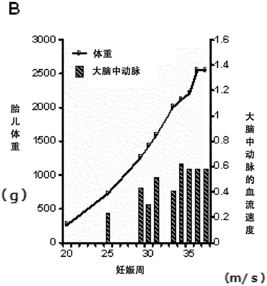 与母体和胎儿的关系中的体液免疫相关的疾病的治疗药