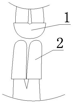 一种大鼠前牙反颌牙冠及其制作方法