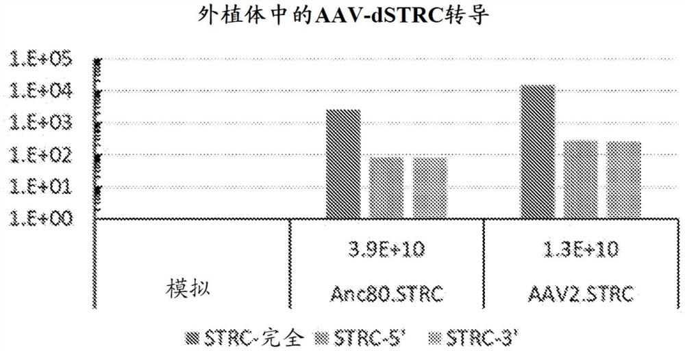 治疗非综合征性感觉神经性听力损失的方法