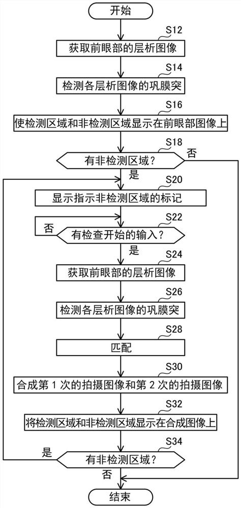 眼科装置