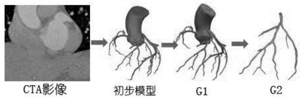 一种利用CTA和DSA测量冠状动脉血流储备分数的方法