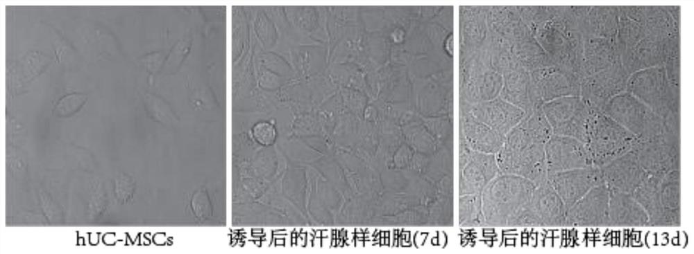 一种干细胞向汗腺样细胞分化的诱导培养基和诱导方法