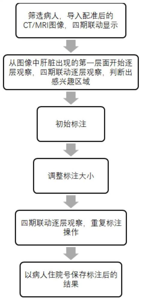 基于图像配准的目标区域标注方法