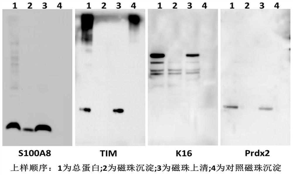 大黄酸作为S100A8的抑制剂在炎症性疾病中的制药应用