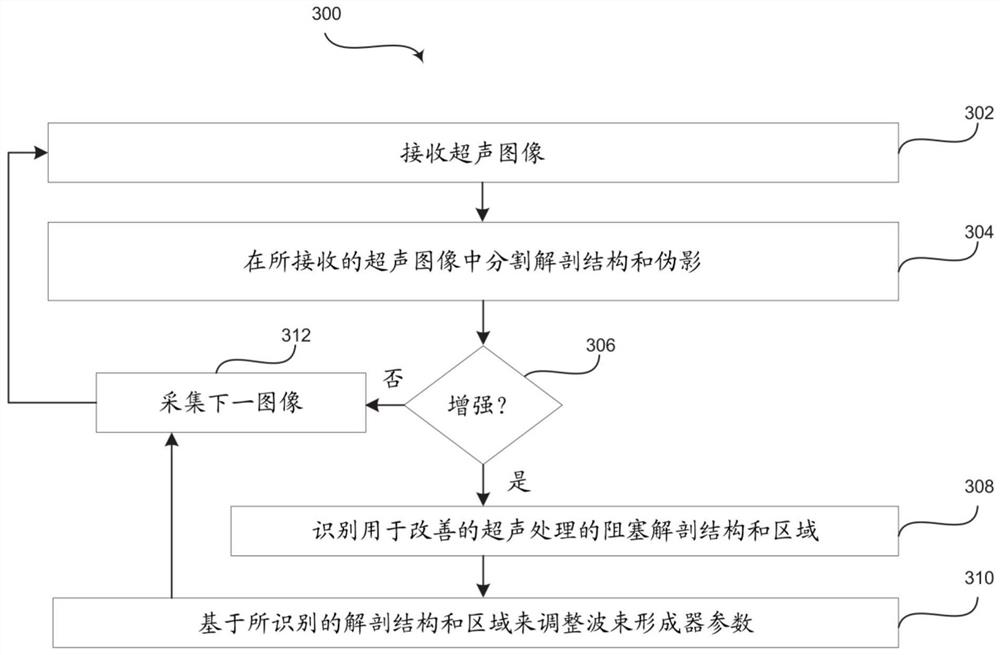 用于通过基于超声图像分析自动调整波束形成器参数来提供超声图像增强的方法和系统