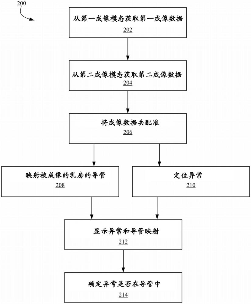 乳房映射和异常定位