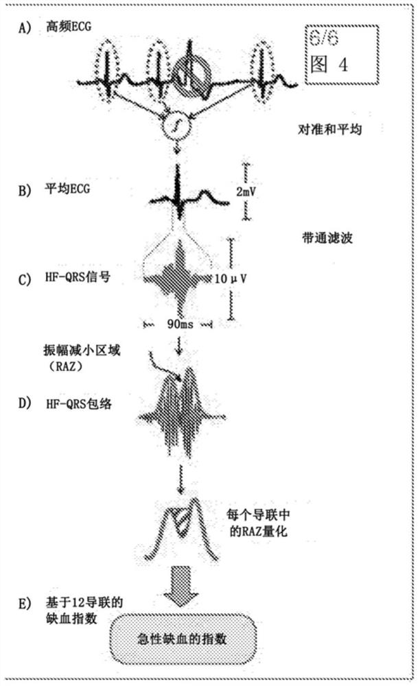 在生物识别中的高频QRS