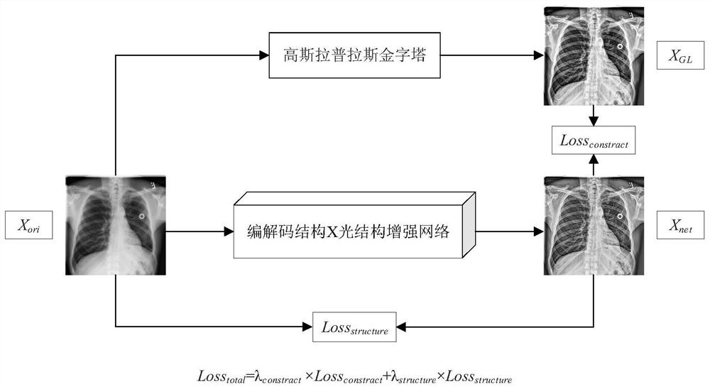 基于高斯-拉普拉斯金字塔的无监督学习X光图像增强方法