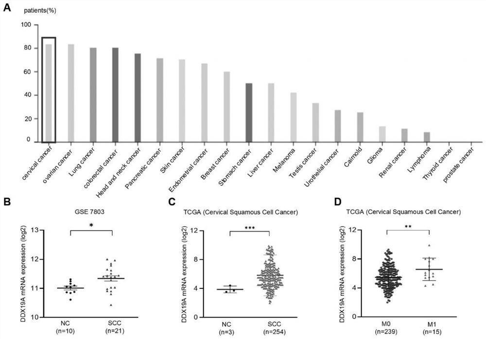 基于DDX19A促进宫颈鳞状细胞癌转移的应用