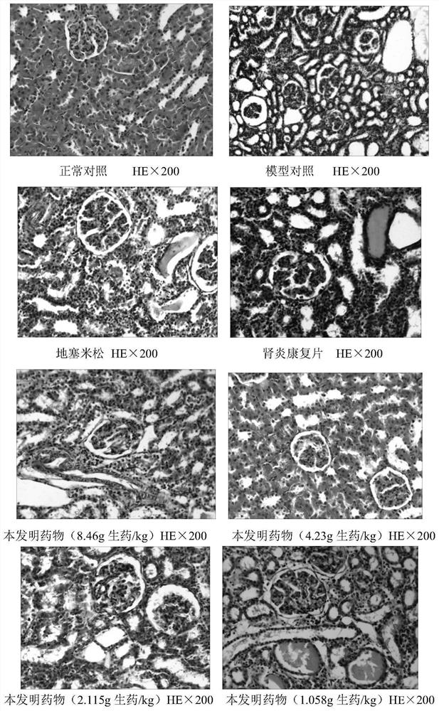 一种治疗慢性肾炎的中药组合物及其制备方法和应用