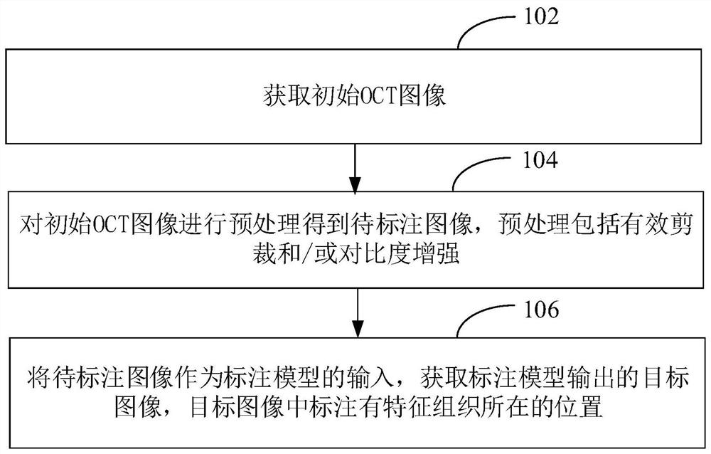 一种特征组织标注方法、装置、计算机设备及存储介质