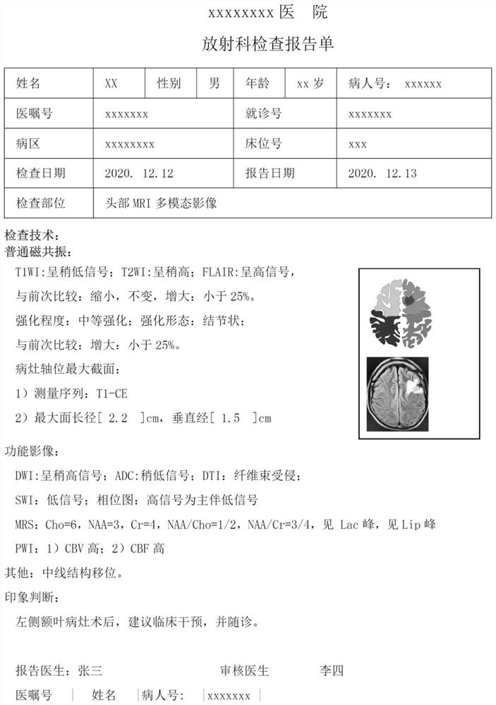 脑肿瘤术后MRI多模态输出系统及方法