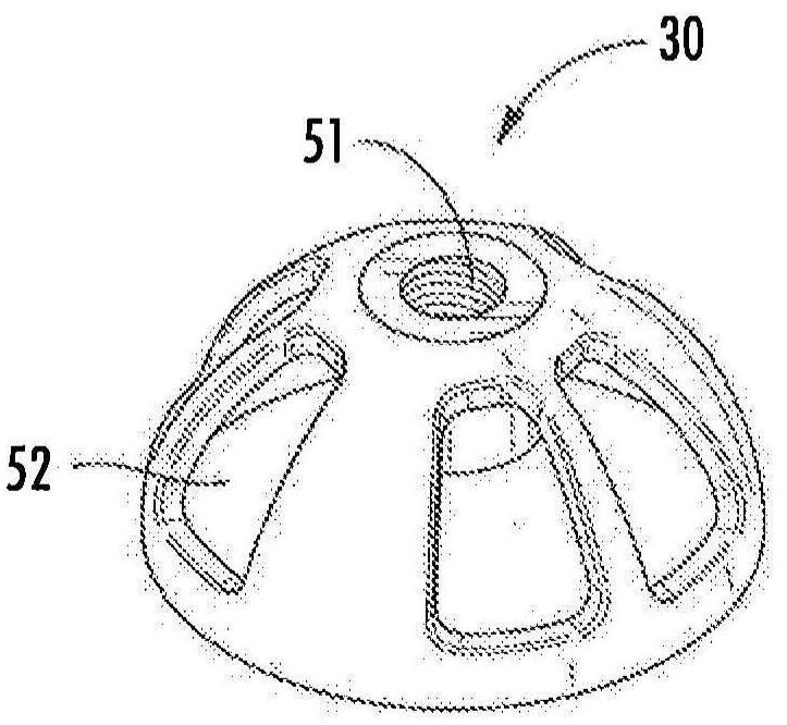 用于植入髋关节置换假体的手术托盘、器械及方法