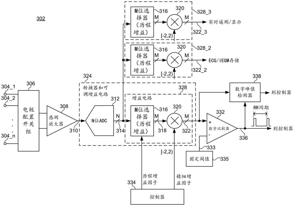 与检测R波相关联的灵敏度的动态控制