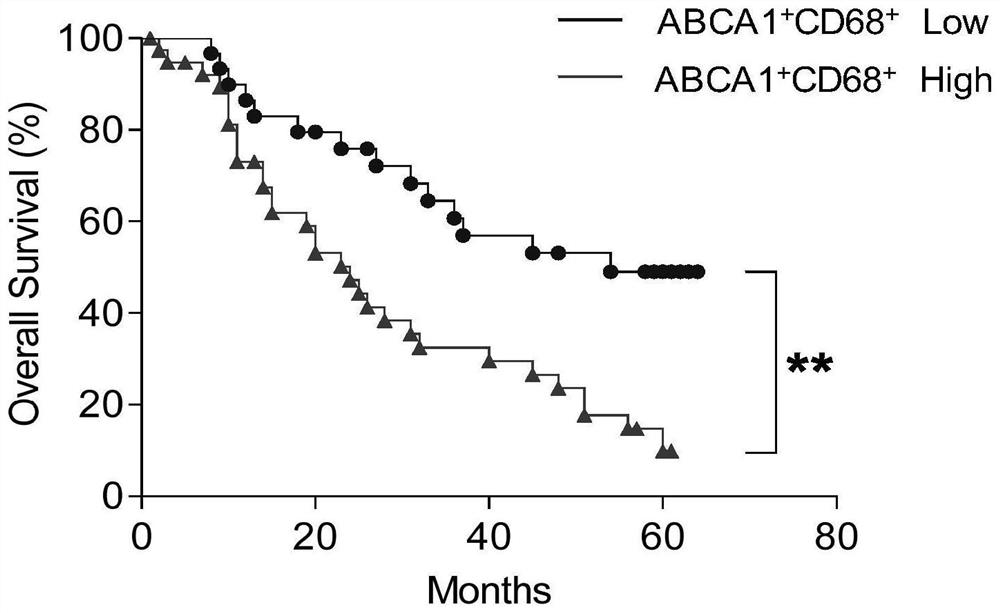 ABCA1与CD68作为预后标记物在制备肝癌预后预测试剂盒中的应用