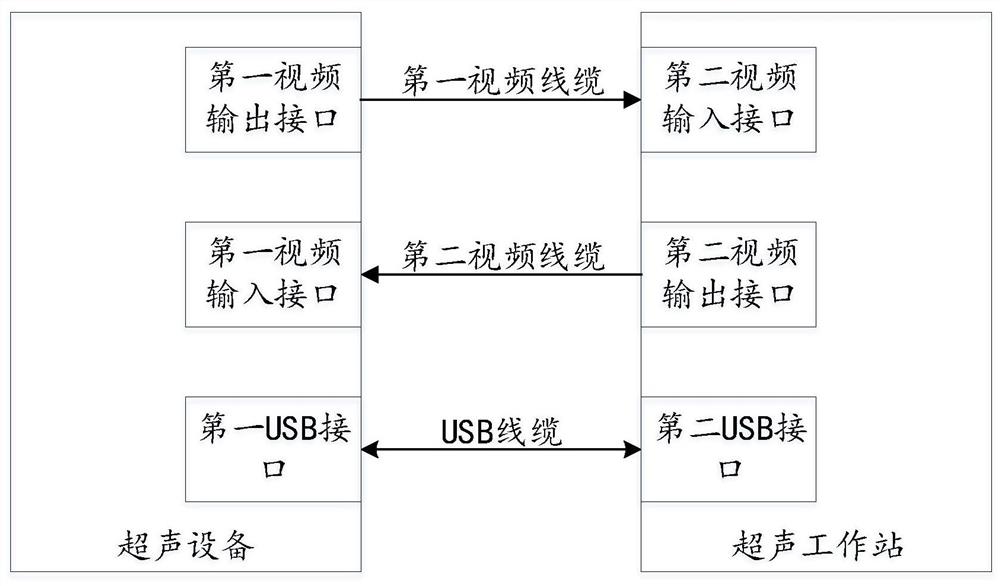 超声图像采集处理系统和超声图像采集处理方法