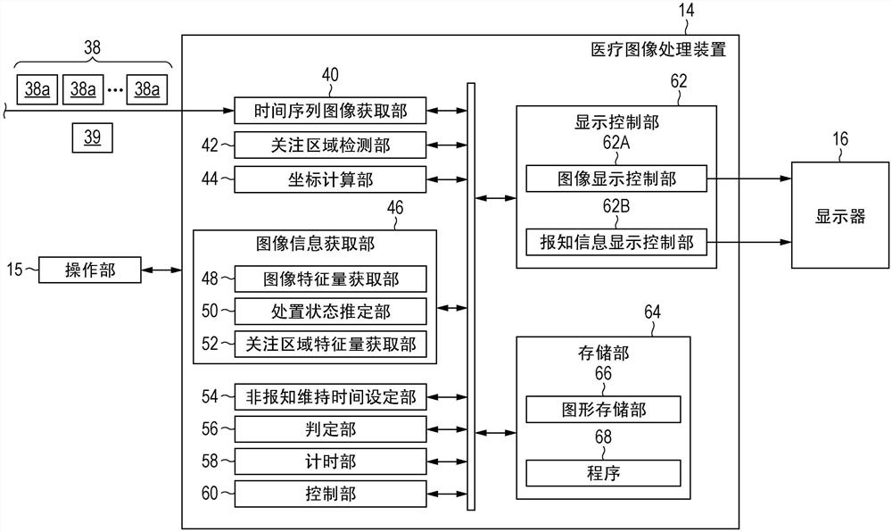 医疗图像处理装置、医疗图像处理方法及程序、诊断辅助装置