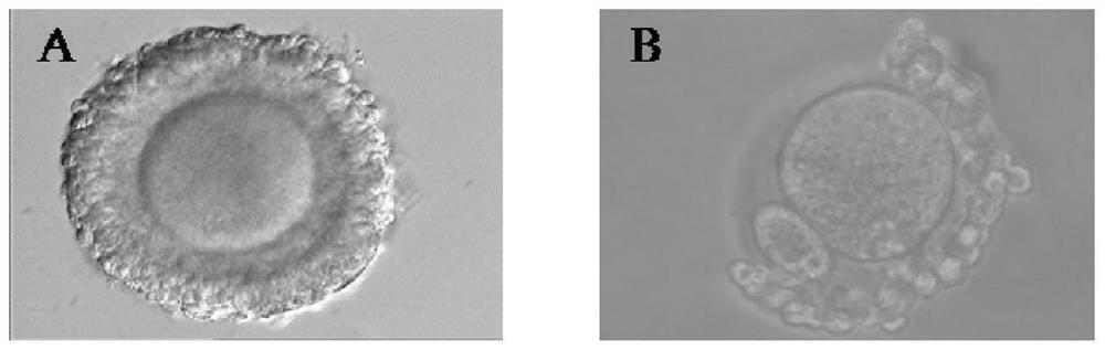 一种体外培养小鼠次级卵泡的方法