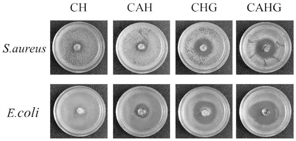 一种基于天然多糖型抗菌水凝胶、制备方法及用途