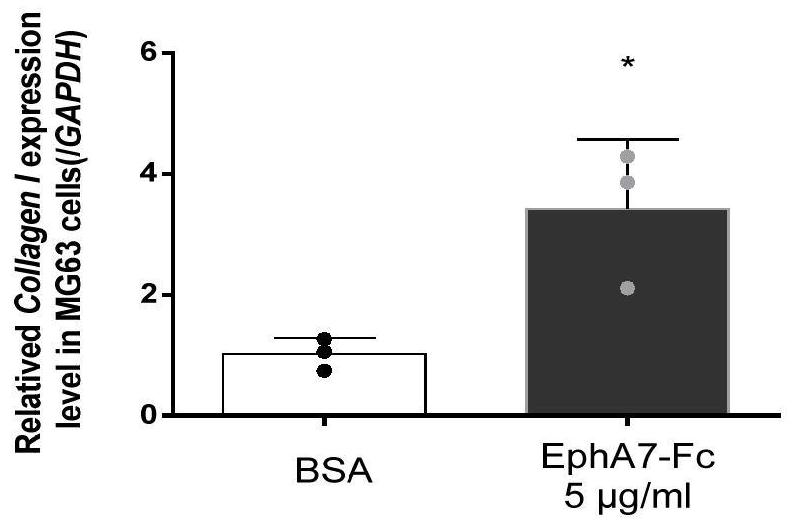 EphA7-Fc融合蛋白及其在预防和/或治疗骨质疏松疾病药物中的应用