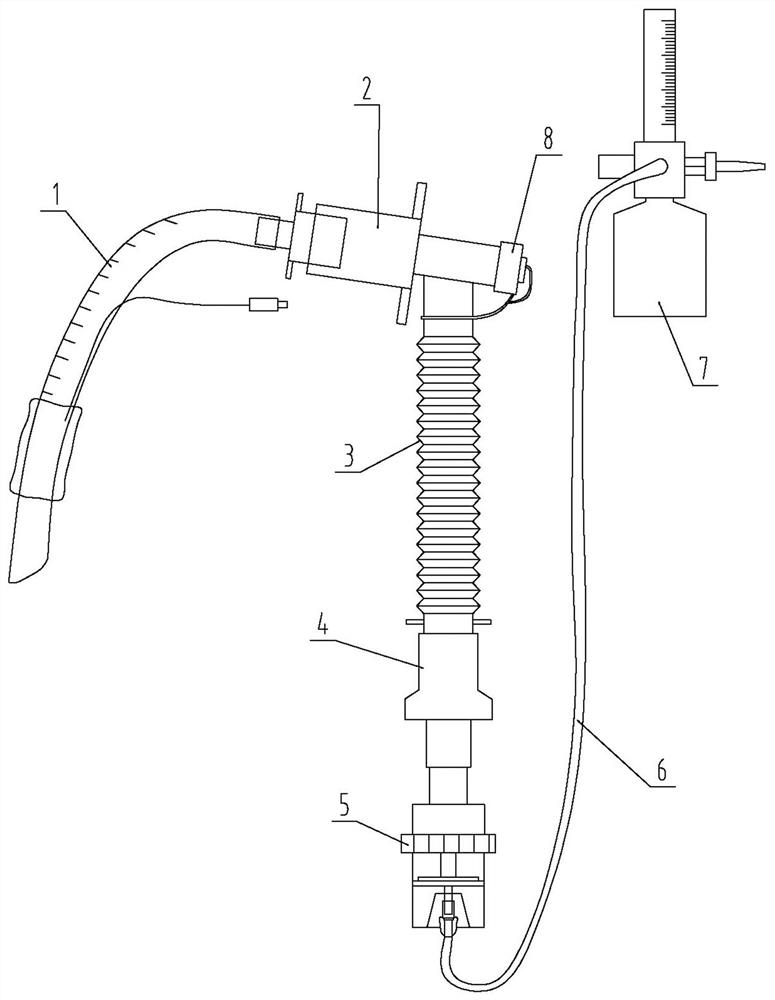 气管插管氧动雾化湿化换气辅助器
