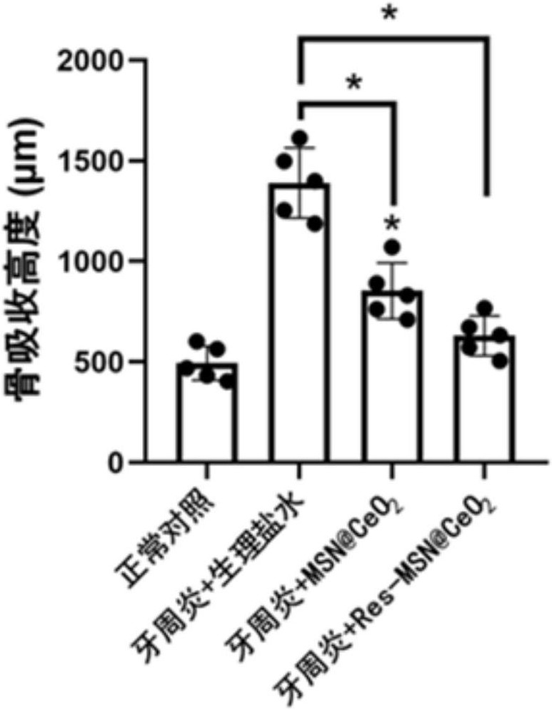 一种用于牙周调控的活性氧响应纳米药物载体及其制备方法