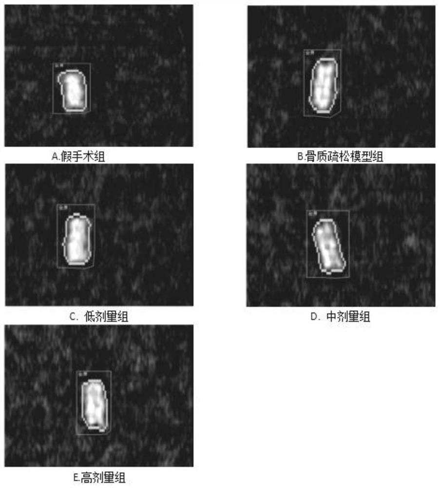 一种治疗骨质疏松的中药制剂及其制备方法