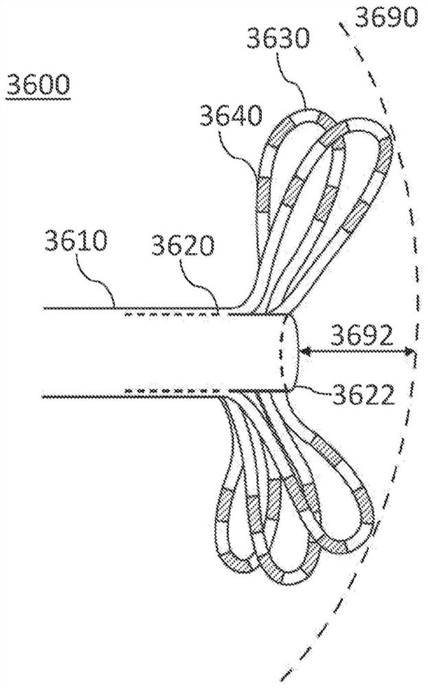 用于将脉冲电场消融能量递送到心内膜组织的系统、装置和方法