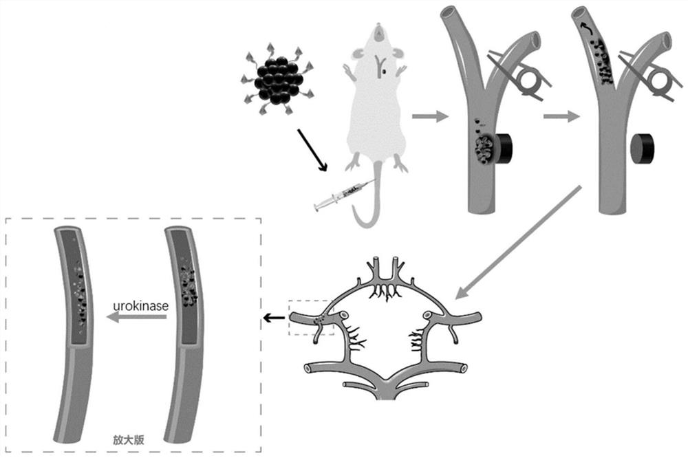 一种微创可溶栓的脑卒中模型的制作方法及应用