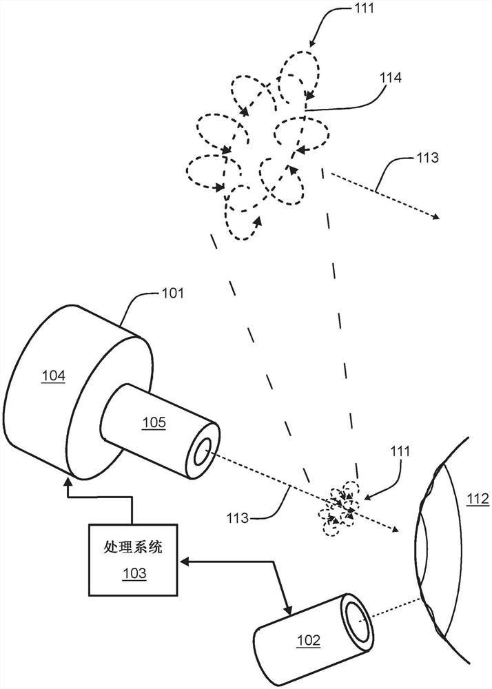 用于测量眼睛压力的系统和方法